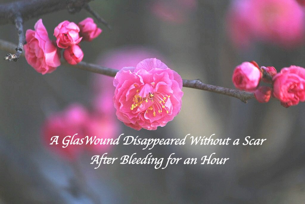A Glass Wound Disappeared Without a Scar After Bleeding for an Hour